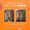 MARYRUTH'S Liquid Multivitamin + Hair Growth